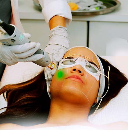 Laser skin tightening