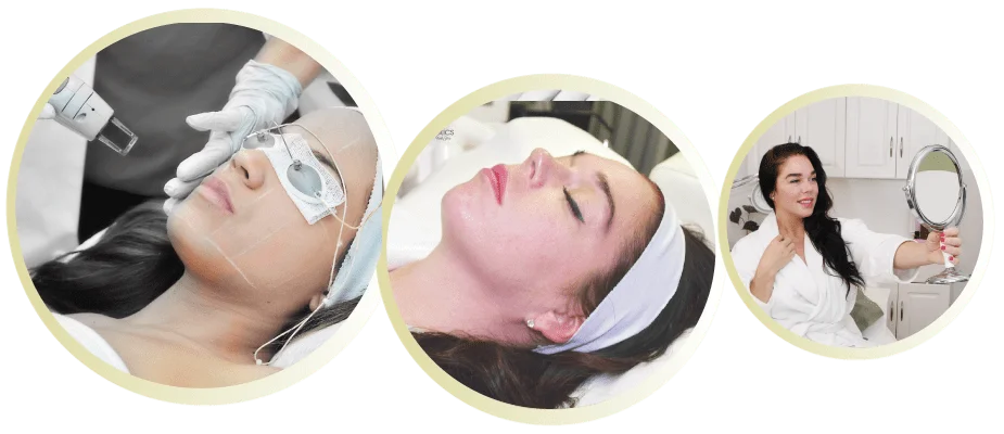 Laser pigmentation removal