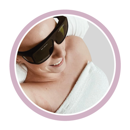 laser-areolas