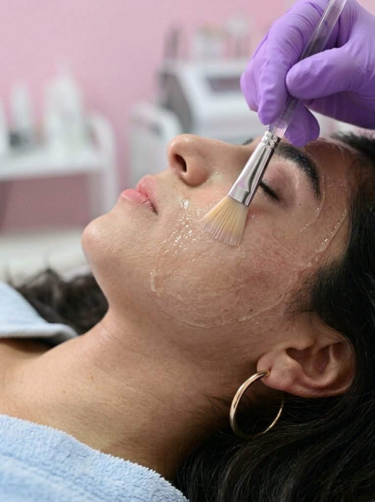 chemical peels in summer